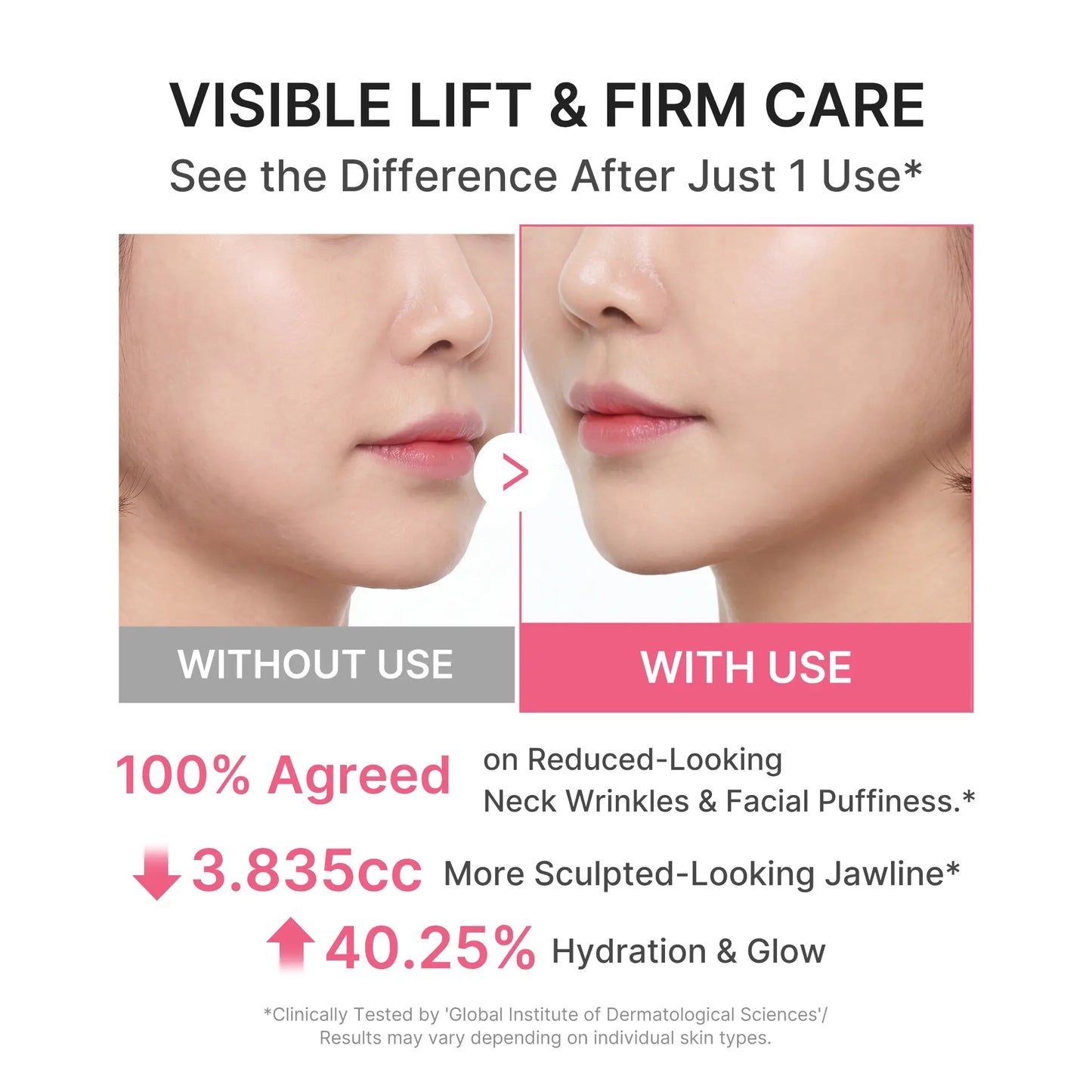 Collagen Neck Wrinkle Cream